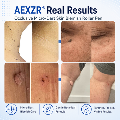 AEXZR® Occlusive Micro-Dart Skin Blemish Roller Pen❄️Painlessly Erase Skin Tags & Warts in 7 Days – No Freeze Burn, No Regrowth ❄️🚫