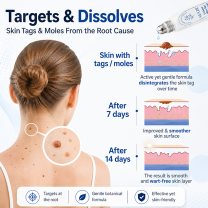 AEXZR® Occlusive Micro-Dart Skin Blemish Roller Pen❄️Painlessly Erase Skin Tags & Warts in 7 Days – No Freeze Burn, No Regrowth ❄️🚫