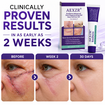 AEXZR® ExoDerm Advanced Scar Regenerating Gel | Marine Spicule Transdermal Scar Repair🧬Instantly Calm Itchy Scars & Smooth Raised Tissue in Weeks 🧬