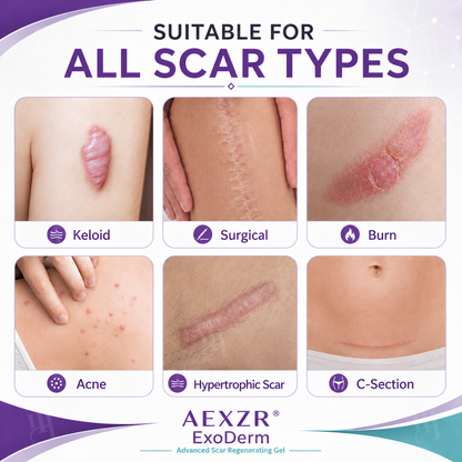 AEXZR® ExoDerm Advanced Scar Regenerating Gel | Marine Spicule Transdermal Scar Repair🧬Instantly Calm Itchy Scars & Smooth Raised Tissue in Weeks 🧬