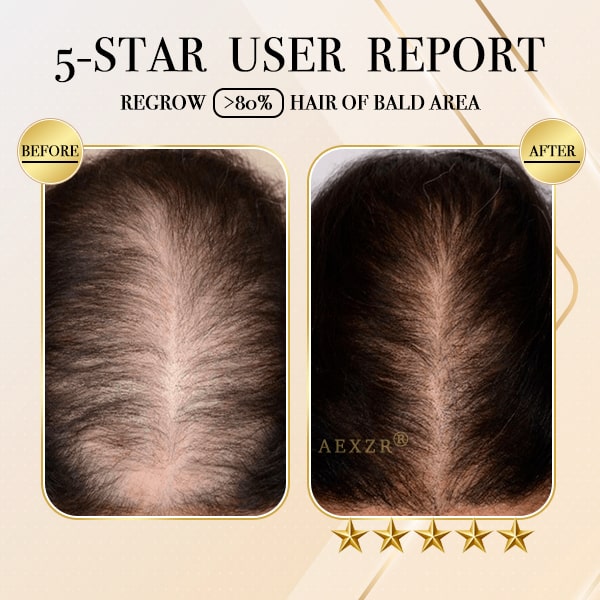 AEXZR® Ginger Hair Regrowth Shampoo Bar